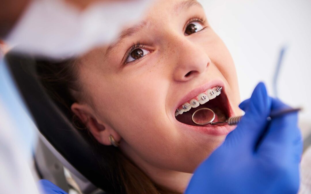 6 Fun Facts About Dental Braces from an Experienced Los Angeles Orthodontist