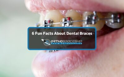 6 Fun Facts About Dental Braces from an Experienced Los Angeles Orthodontist