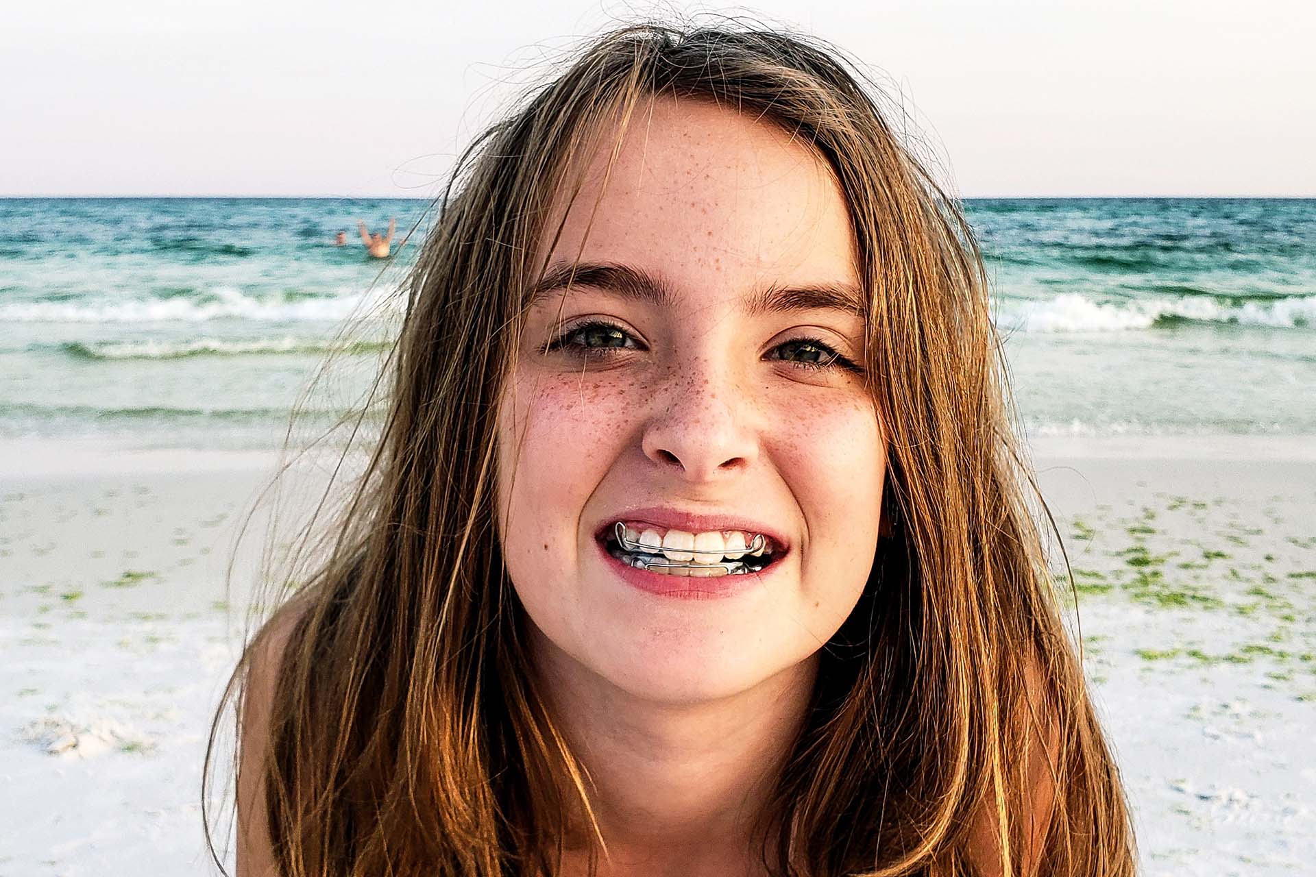 Young girl at a beach in Los Angeles showing off her Hawley retainer and permanent retainer in her mouth