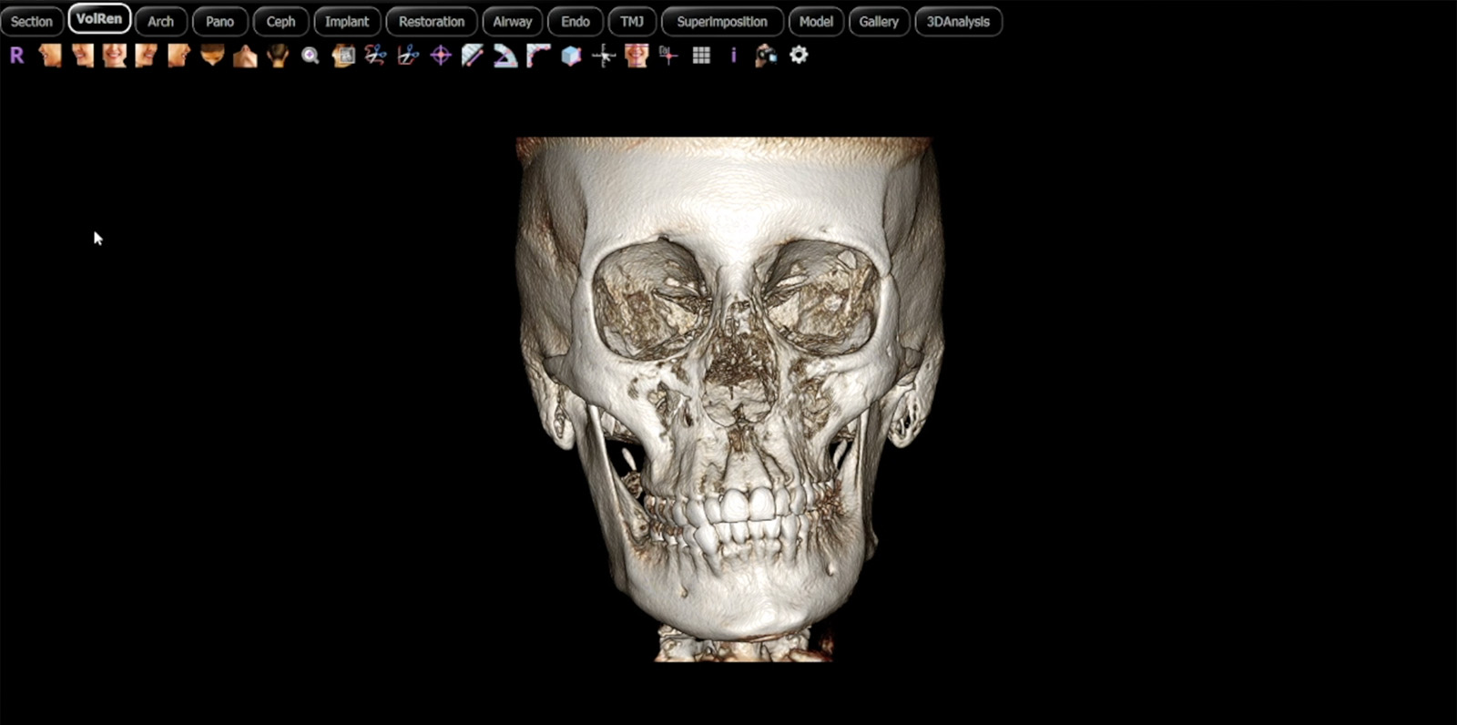 Detailed 3D image generated by DEXIS i-CAT FLX V device enables superior orthodontic treatment in LA
