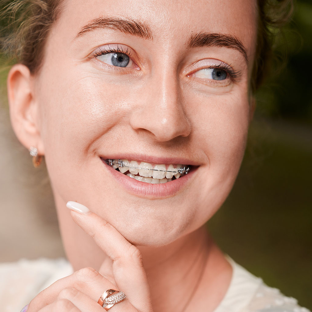 Elegant woman with ceramic braces from the best orthodontist in Los Angeles, Dr. Hakim