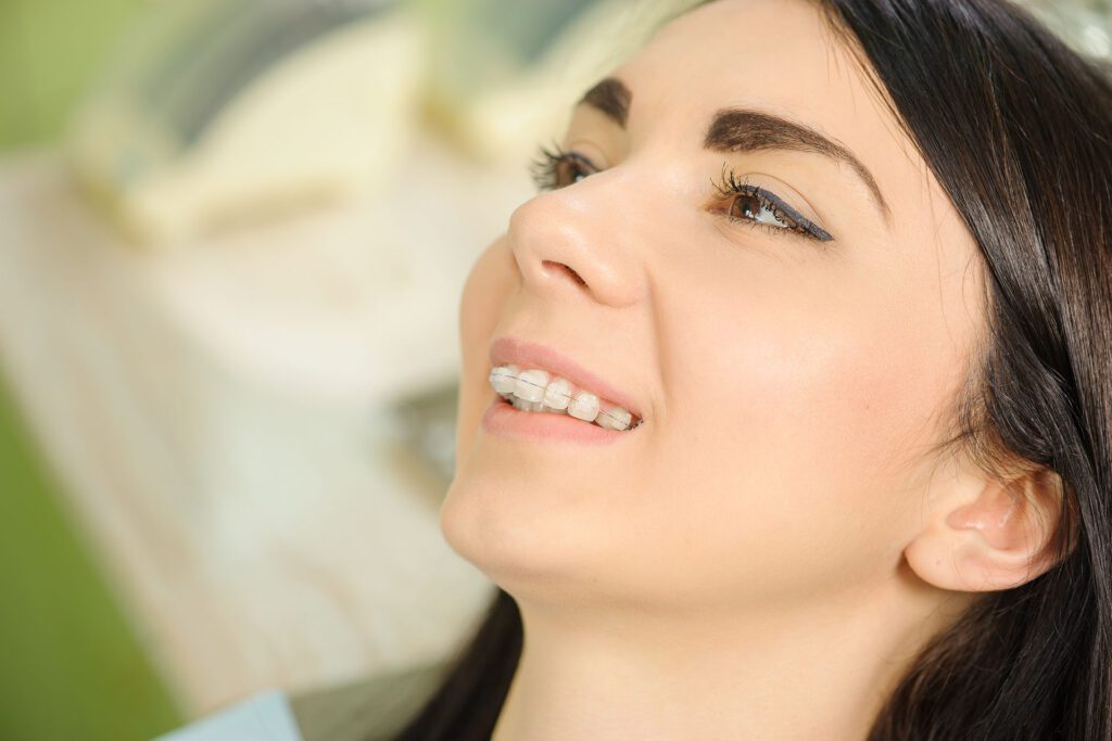 Ceramic braces are made of composite material rather than metal, making them less visible.
