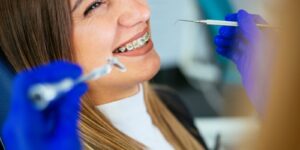 average cost of braces in Los Angeles