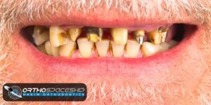 Choosing the Right Orthodontist in Los Angeles