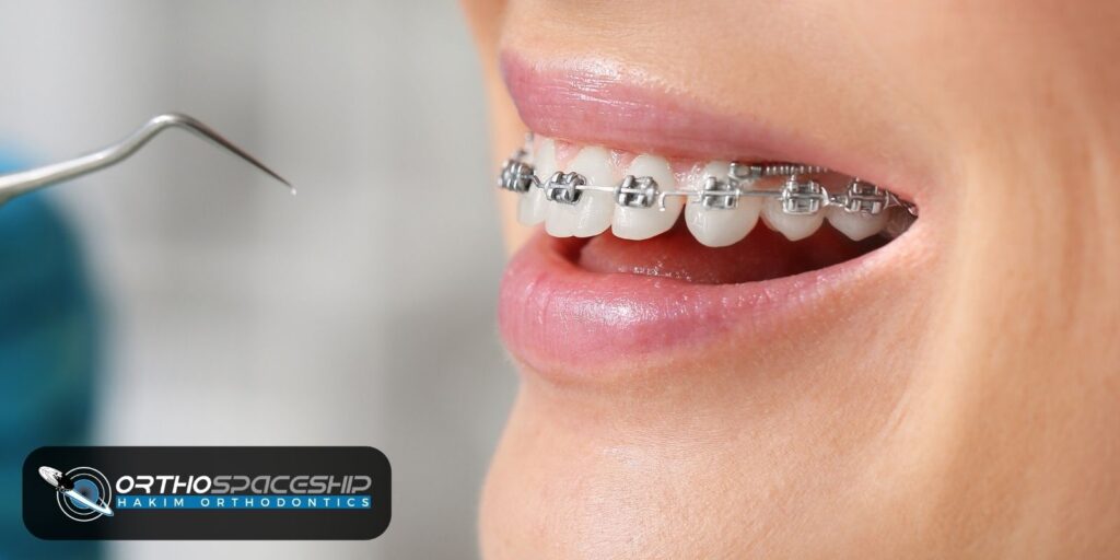 Ask Us - Problems with your brace - Herts Orthodontics in