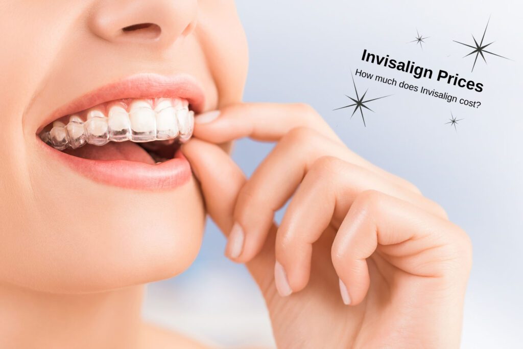 Woman inserting an Invisalign clear aligner. What does Invisalign treatment cost in Los Angeles?