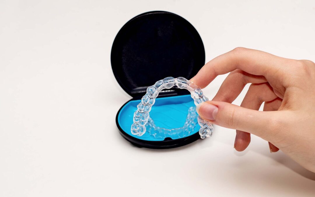 Invisalign Cost in Los Angeles: What You Need to Know