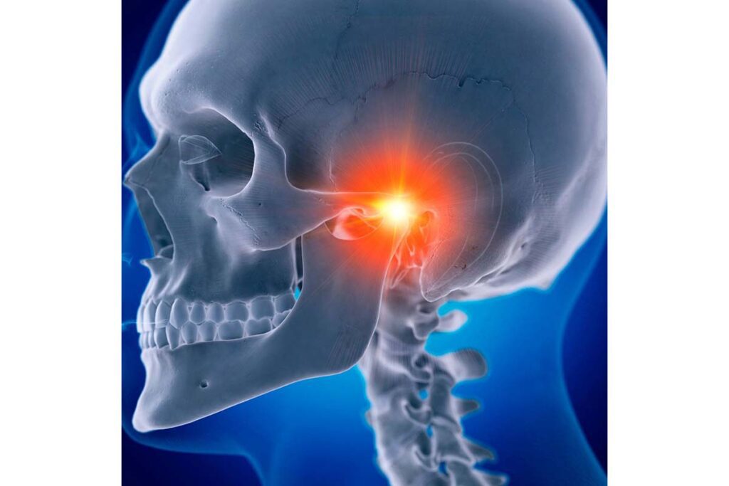 Skull showing temporal bone and temporomandibular joint 