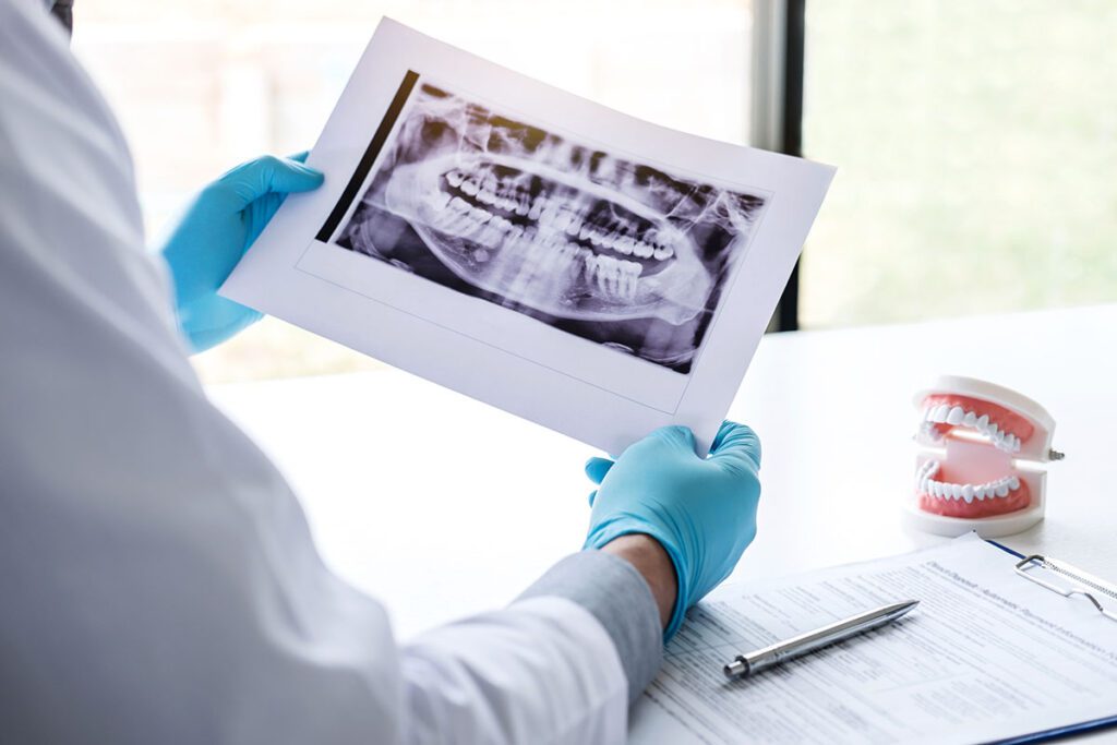An orthodontist reviewing an x-ray of patient with TMJ disorder