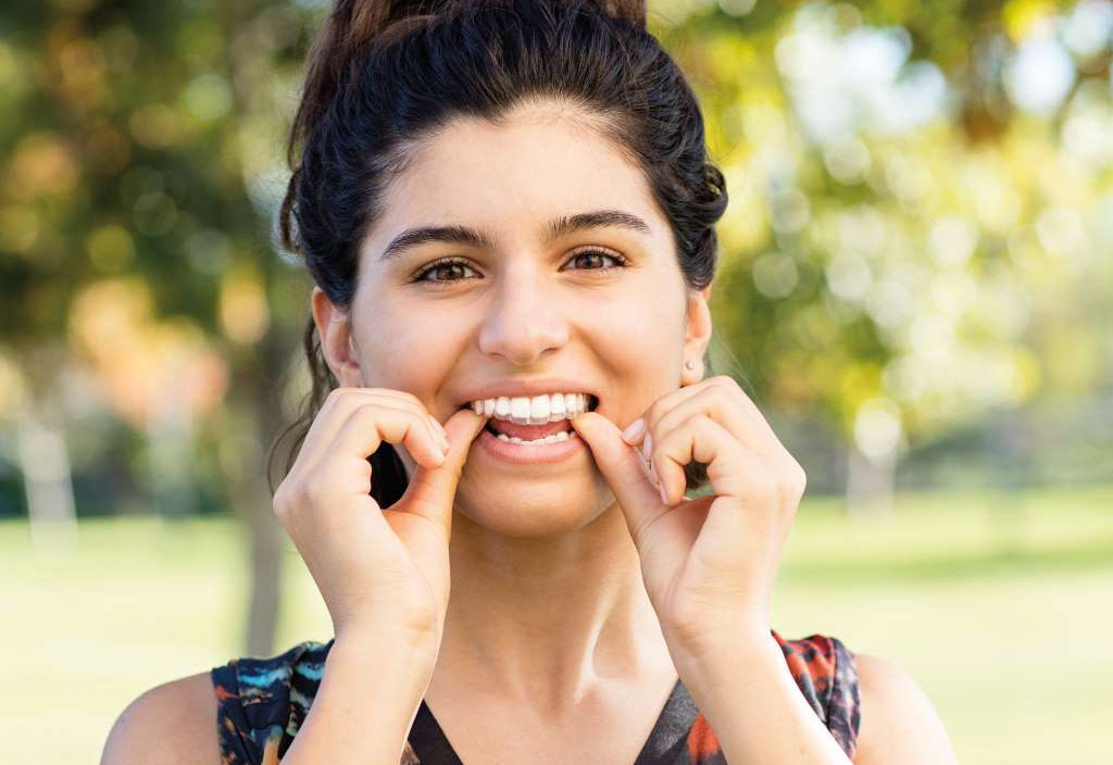 Young woman in process of Invisalign treatment to fix her crooked teeth