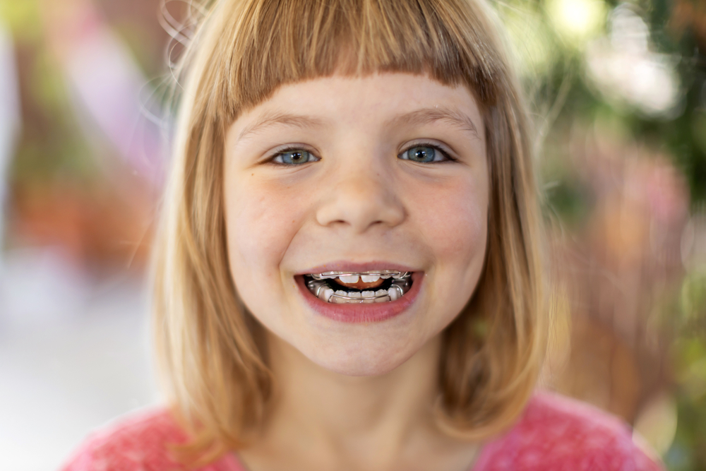 Can My Child Get Braces with Baby Teeth Still Present?