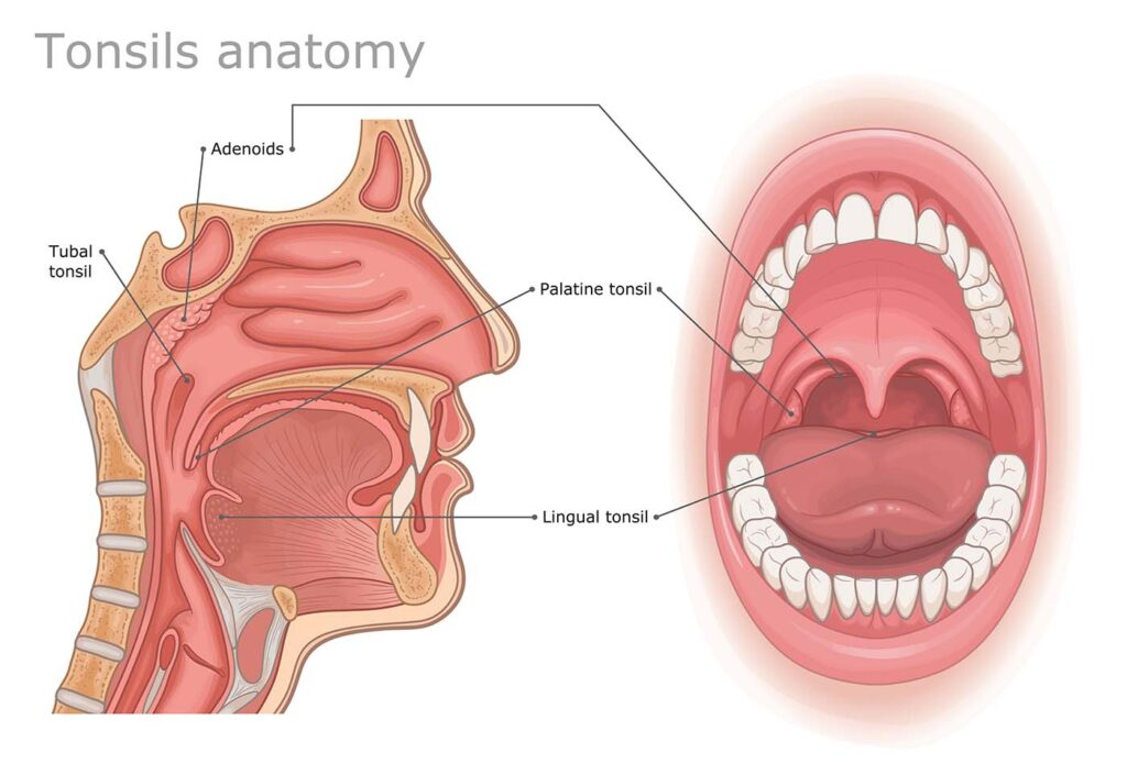 Throat illustration of pointing out tonsils and adenoids.