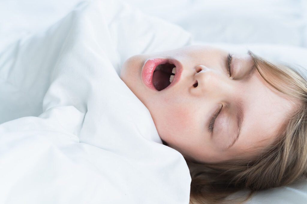 Enlarged tonsils and adenoids can result in mouth breathing and loud snoring.