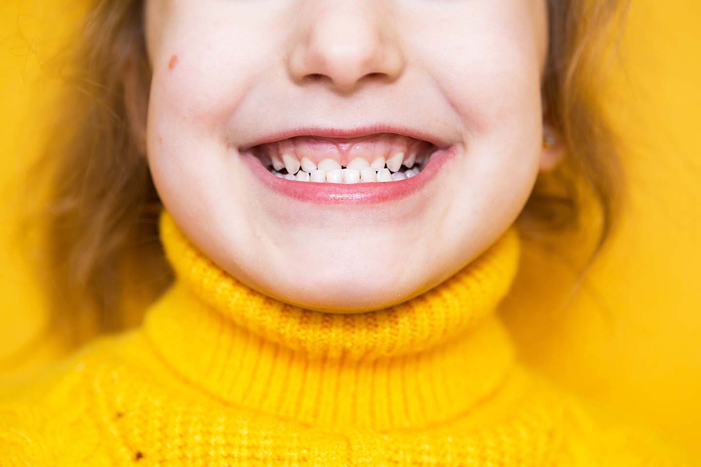 close up of young girl's mouth with an underbite